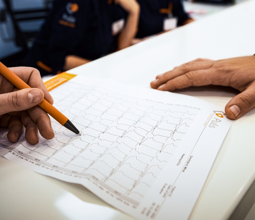 Electrocardiogram