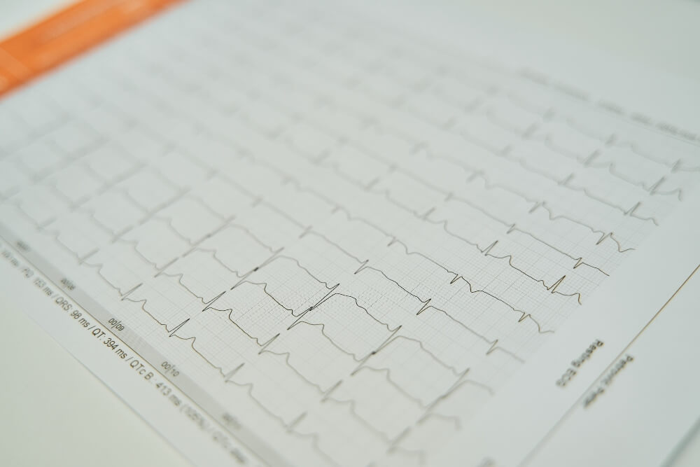 Patinet ECG - Echocardiogram
