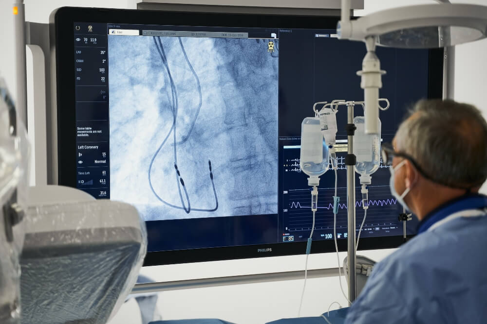 Doctor during the performance of coronary angiography