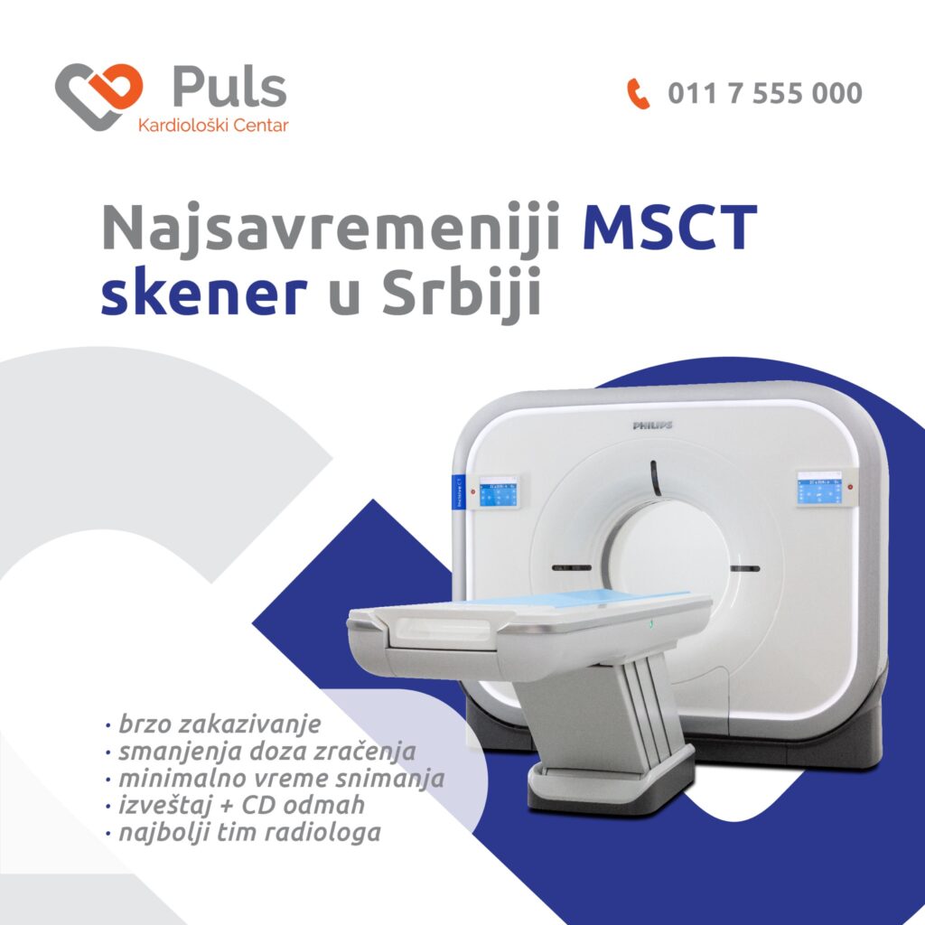 Most modern CT Scanner in Serbia